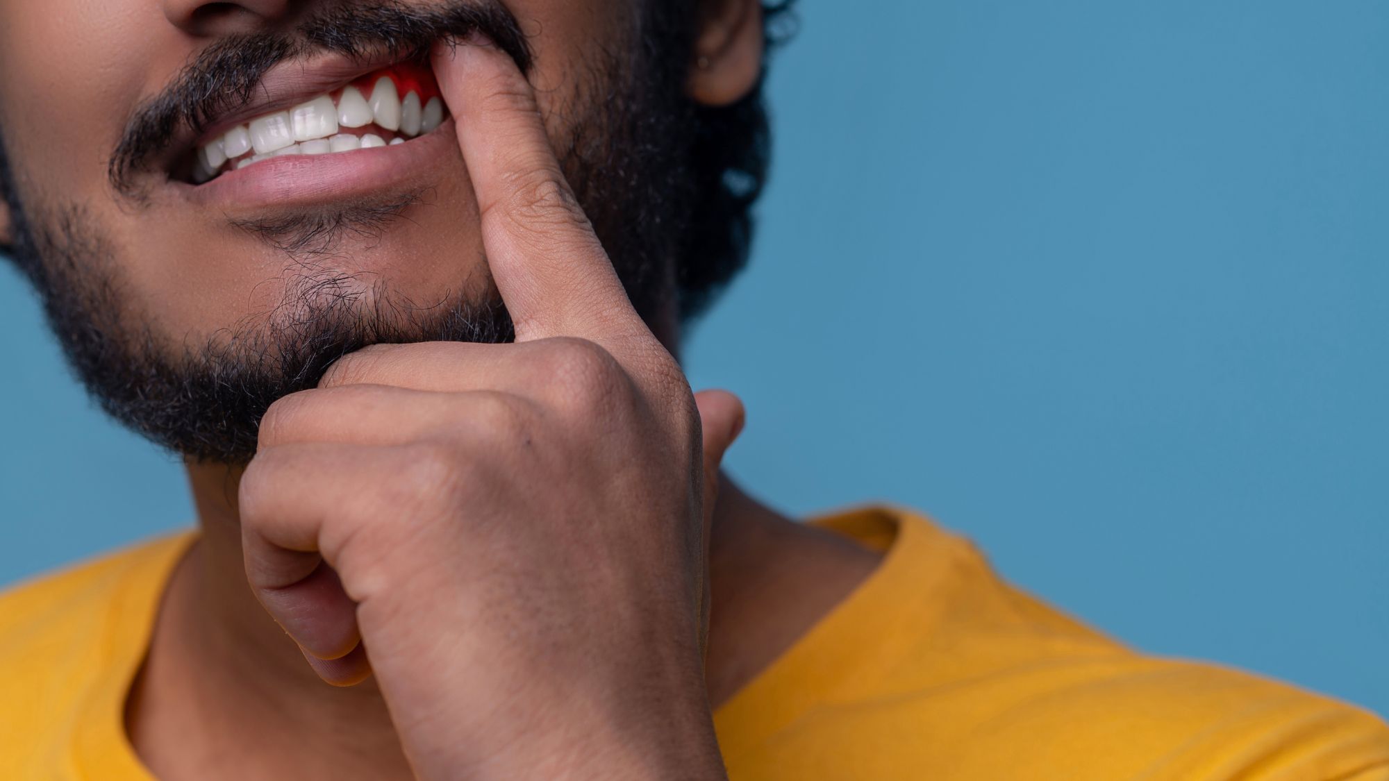 A boy proudly showcases his tooth while experiencing bleeding gums, indicating a dental issue