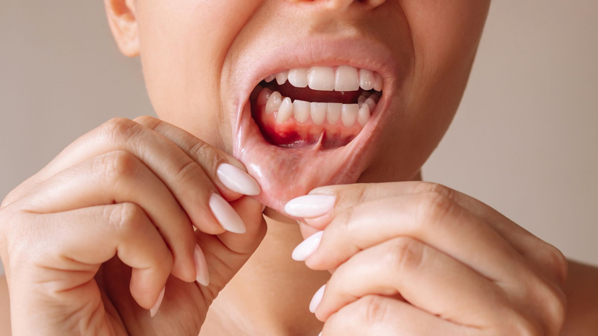 A woman demonstrating how stress can lead to gum bleeding