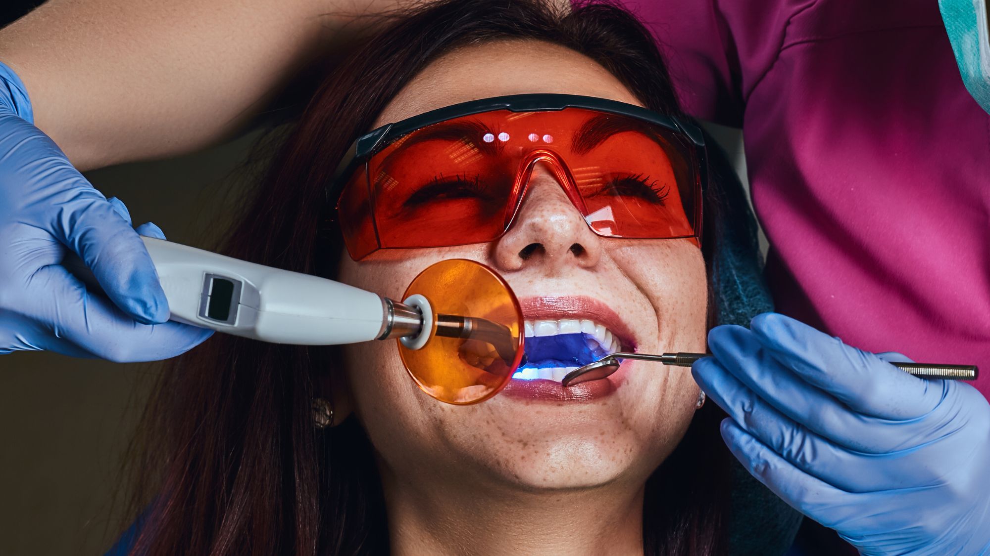 Woman undergoing a professional teeth whitening treatment at the dentist
