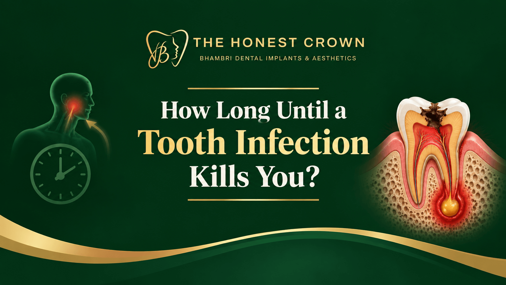 How long until a tooth infection kills you? Dental infographic showing an infected tooth cross-section, facial pain illustration, and clock on a dark green and gold background