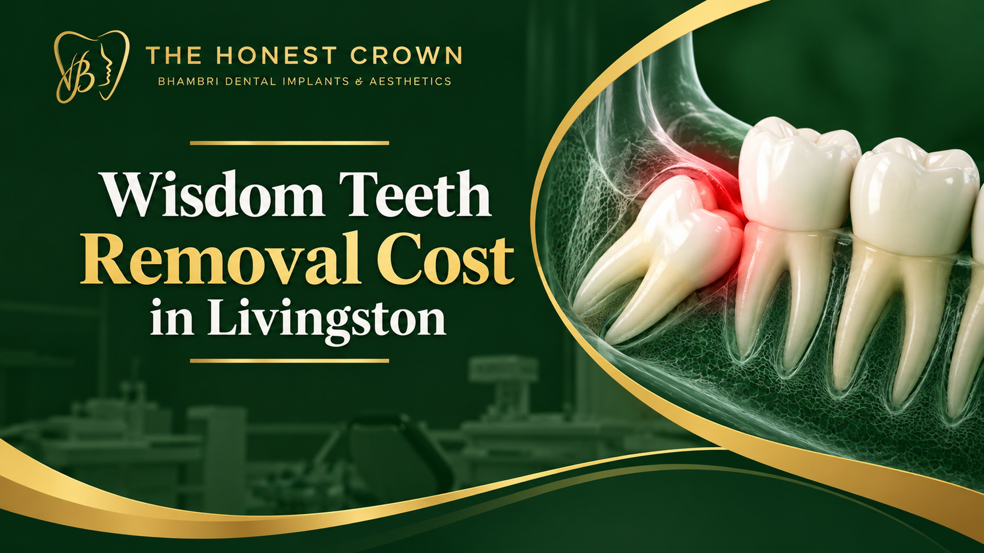 Wisdom teeth removal cost in Livingston, NJ, featuring an illustration of an impacted wisdom tooth
