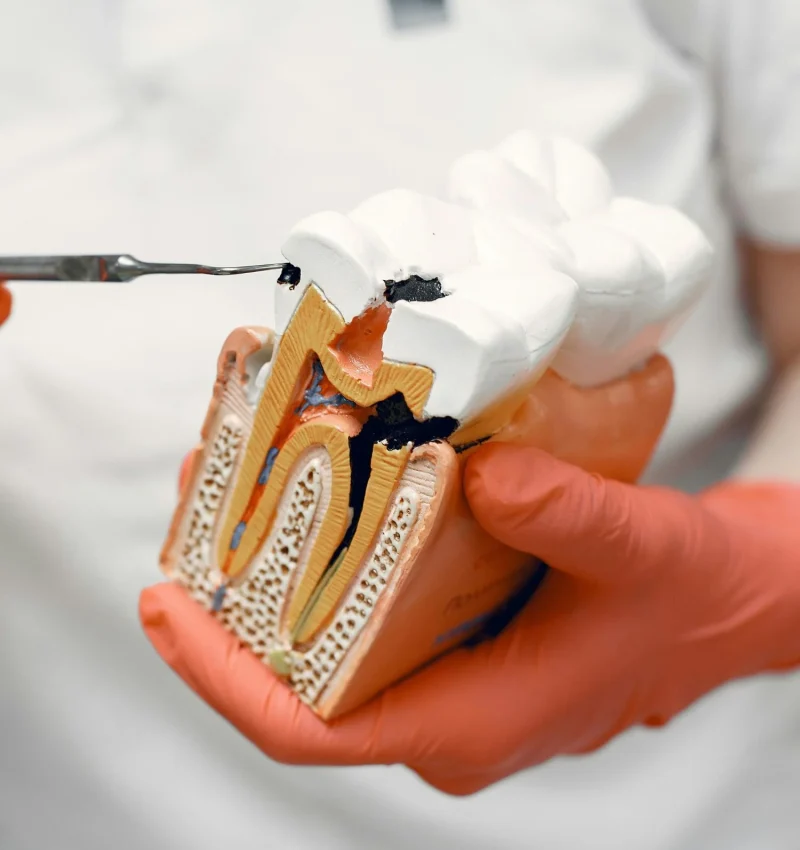 A dentist showing a sample illustration of teeth and root canal retreatment